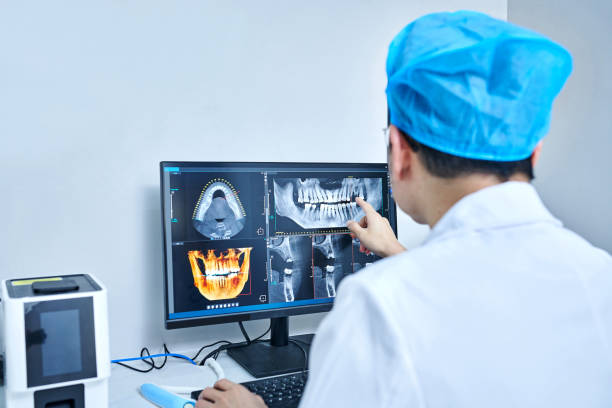 Best Emergency Root Canal Treatment in Montgomeryville, PA